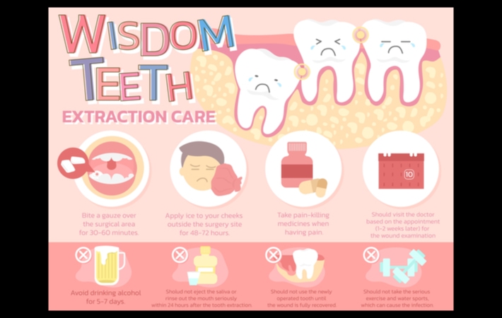 Just Got Your Wisdom Teeth Out Here S What You Can And Can T Do   Image4 