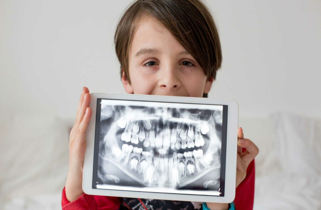A young boy sitting against a back holding an iPad showing his dental x-ray.
