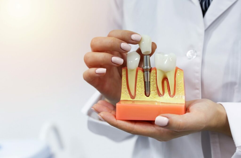 A cross-section model of a mouth with a tooth implant being held by a dentist.