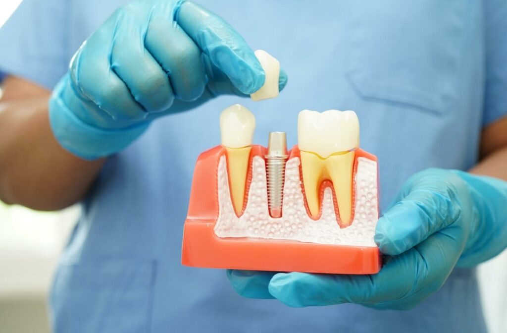 A dentist holding a model of a root canal procedure.