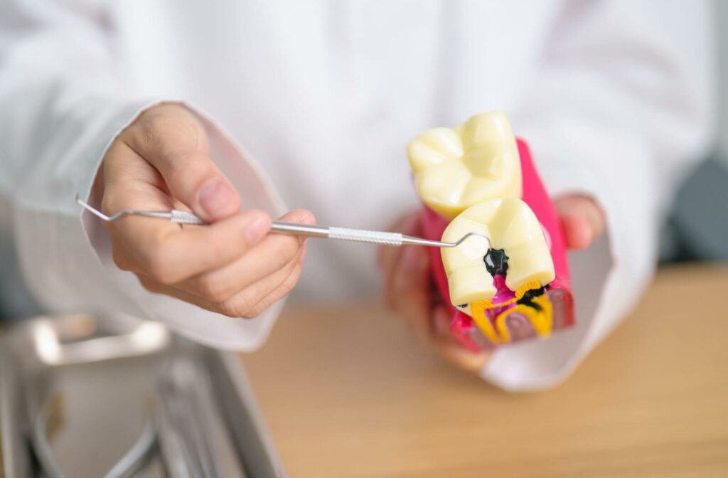 A dentist uses a scraping tool to point to a model of a tooth cavity.