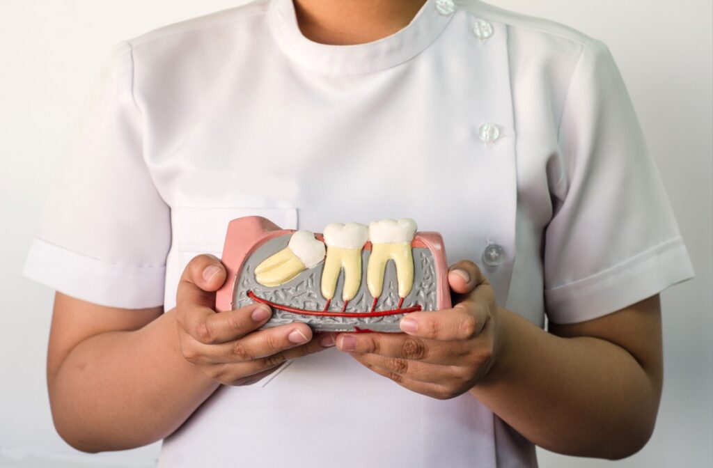 A dental model showing impacted wisdom teeth.
