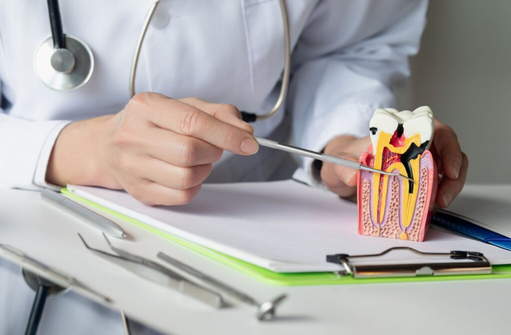 A person (face not shown) in a white coat and stethoscope pointing a dental instrument at a cross section model of a tooth that shows black infected pulp.